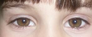 Congenital malformations 19