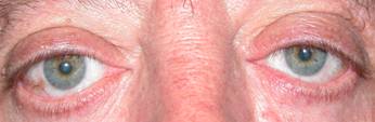 Thyroid 20